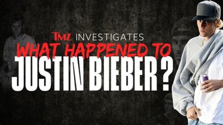 Justin Bieber: Why He Needed Cupping Done On His Chest — Expert Speaks